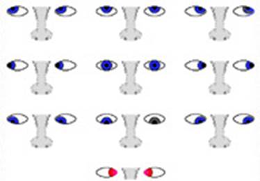 eye-muscles2